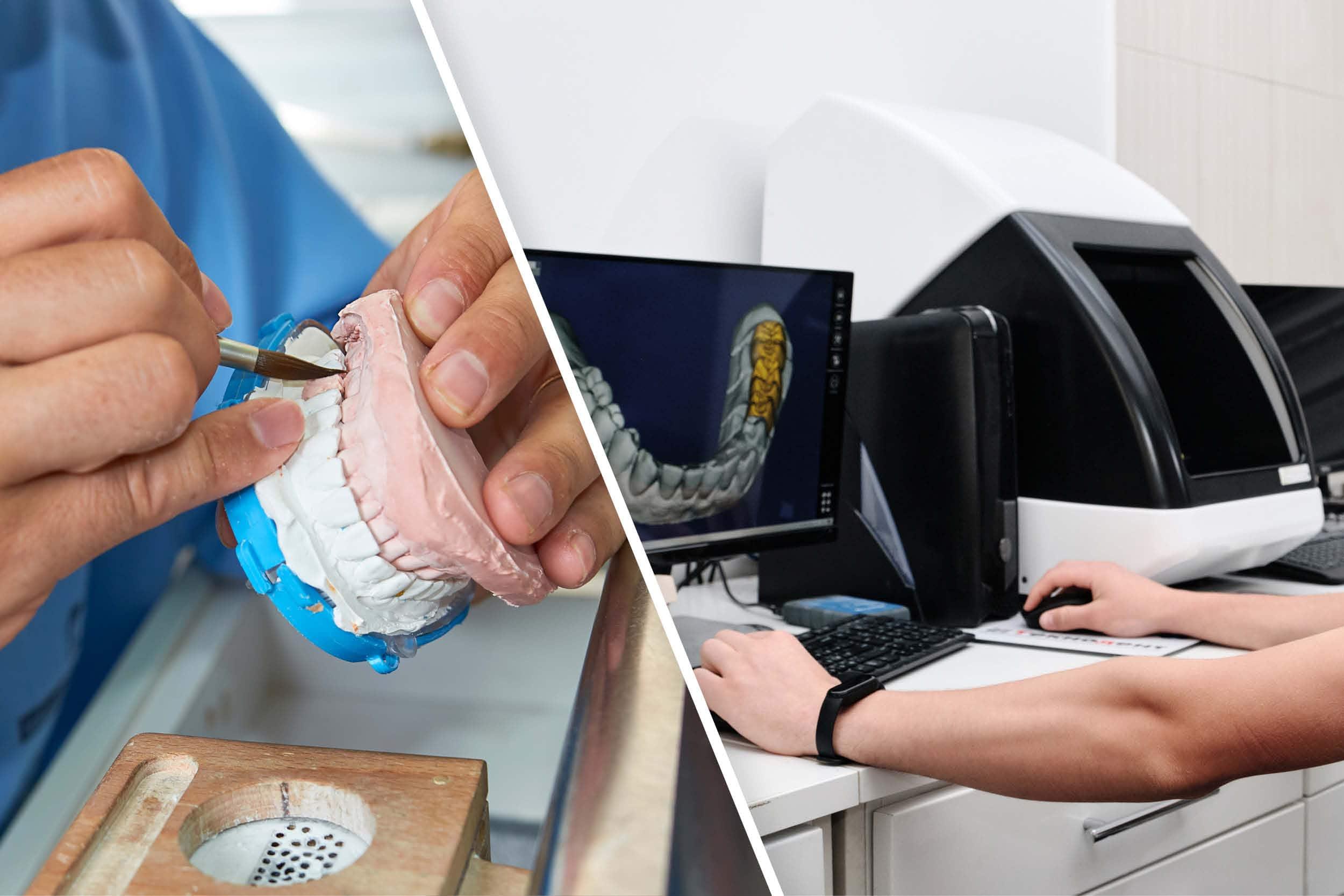 Veneers Outsourcing Dental Lab: Soluzioni scalabili per faccette estetiche per cliniche